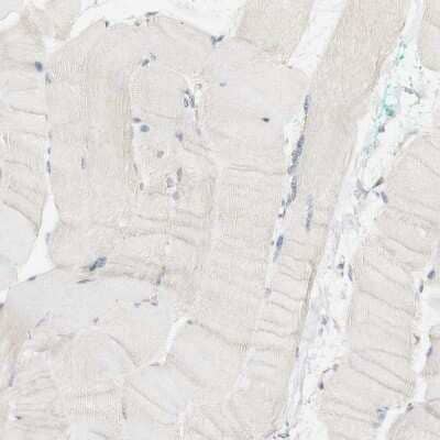Immunohistochemistry-Paraffin: SYT7 Antibody [NBP1-81588]