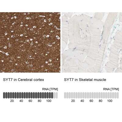 Immunohistochemistry-Paraffin: SYT7 Antibody [NBP1-81588]