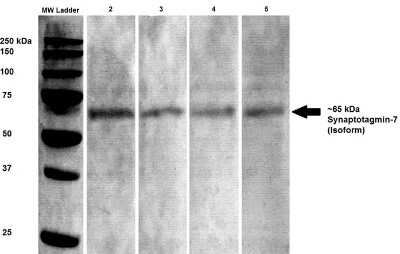 Western Blot: SYT7 Antibody (S275-14) [NBP2-22420]