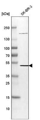Western Blot: SYT7 Antibody [NBP1-81588]