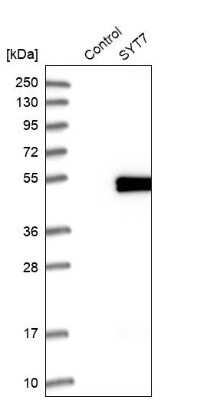 Western Blot: SYT7 Antibody [NBP1-81588]