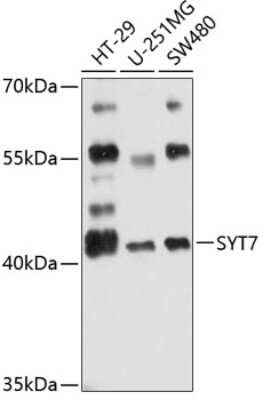 Western Blot: SYT7 AntibodyAzide and BSA Free [NBP2-93228]