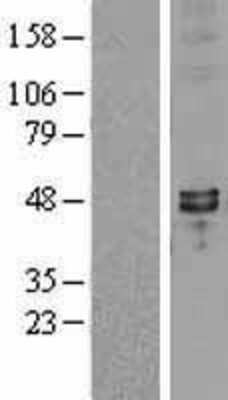 Western Blot: SYT7 Overexpression Lysate [NBL1-16655]