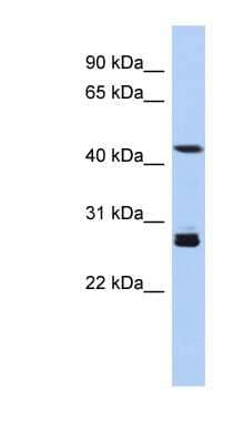 Western Blot: SYT9 Antibody [NBP1-60112]