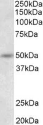 Western Blot: SYT9 Antibody [NBP2-26143]