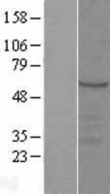 Western Blot: SYT9 Overexpression Lysate [NBL1-16656]