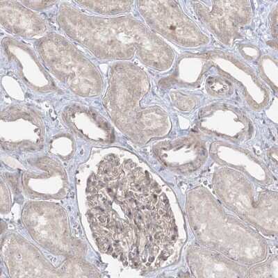 Immunohistochemistry-Paraffin: SYTL1 Antibody [NBP1-84764]