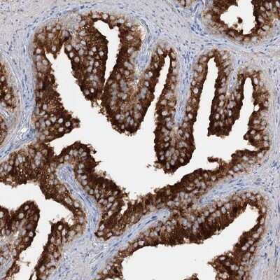 Immunohistochemistry-Paraffin: SYTL1 Antibody [NBP1-84764]