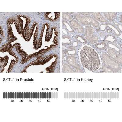 Immunohistochemistry-Paraffin: SYTL1 Antibody [NBP1-84764]