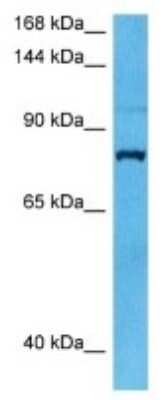 Western Blot: SYTL2 Antibody [NBP3-10010]