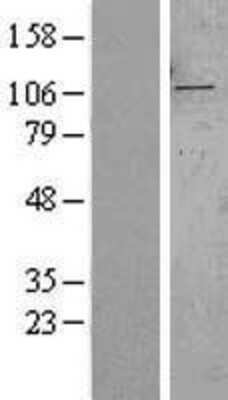 Western Blot: SYTL2 Overexpression Lysate [NBL1-16657]