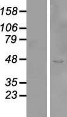 Western Blot: SYTL2 Overexpression Lysate [NBP2-09932]