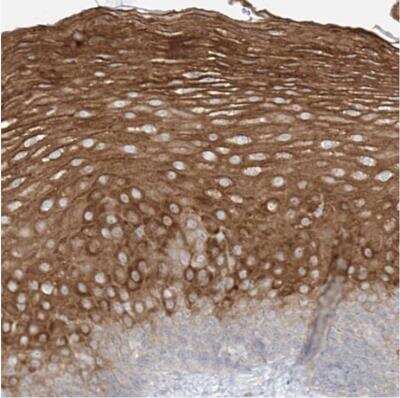 Immunohistochemistry-Paraffin: SYTL3 Antibody [NBP1-83942]