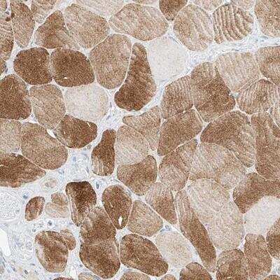 Immunohistochemistry-Paraffin: SYTL3 Antibody [NBP1-83943]