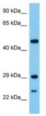 Western Blot: SYTL3 Antibody [NBP3-10149]