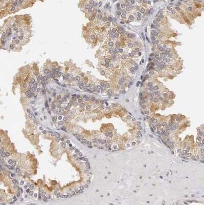 Immunohistochemistry-Paraffin: SYTL4 Antibody [NBP1-86174]