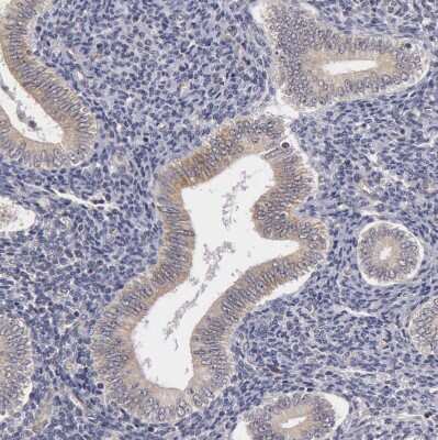 Immunohistochemistry-Paraffin: SYTL4 Antibody [NBP1-86174]