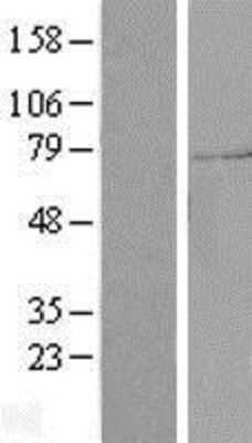 Western Blot: SYTL4 Overexpression Lysate [NBP2-09493]