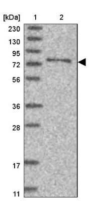 Western Blot: SYTL5 Antibody [NBP1-90926]