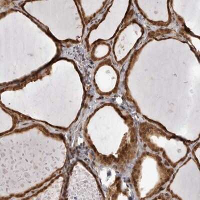 Immunohistochemistry-Paraffin: SZRD1 Antibody [NBP1-85074]