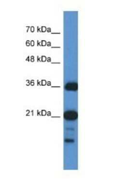 Western Blot: SZRD1 Antibody [NBP1-57737]