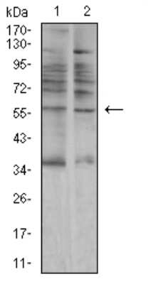 Western Blot: Salivary Amylase Alpha Antibody (5G6F7)BSA Free [NBP2-61862]