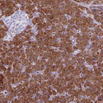 Immunohistochemistry-Paraffin: Salivary Amylase Alpha Antibody [NBP2-46735]