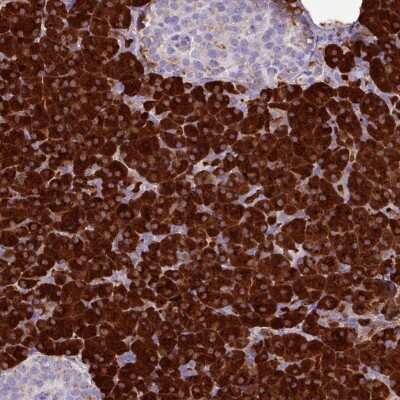 Immunohistochemistry-Paraffin: Salivary Amylase Alpha Antibody [NBP2-46713]