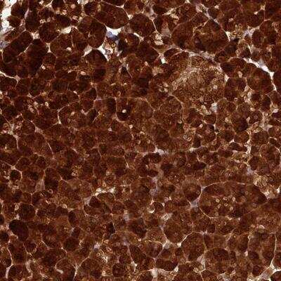 Immunohistochemistry-Paraffin: Salivary Amylase Alpha Antibody [NBP2-46714]