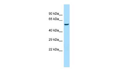 Western Blot: Salivary Amylase Alpha Antibody [NBP3-09325]