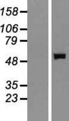 Western Blot: Salivary Amylase Alpha Overexpression Lysate [NBP2-10560]