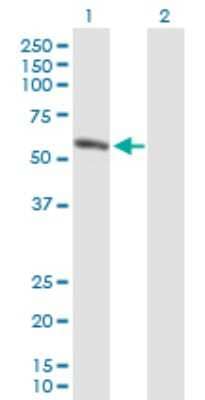 Western Blot: Salivary Amylase Beta Antibody [H00000277-B01P]