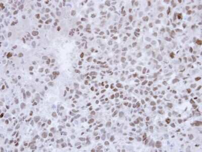 Immunohistochemistry-Paraffin: SALL4 Antibody [NBP1-32969]