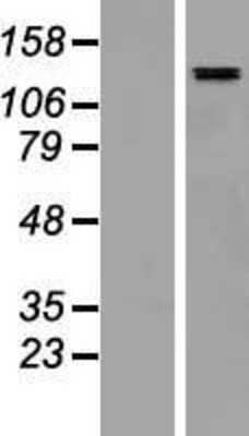 Western Blot: SALL4 Overexpression Lysate [NBP2-06650]