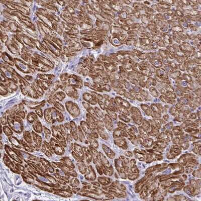Immunohistochemistry-Paraffin: Sarcalumenin Antibody [NBP2-13378]