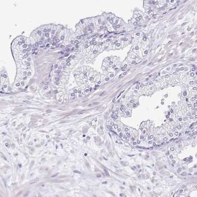 Immunohistochemistry-Paraffin: Sarcalumenin Antibody [NBP2-13378]