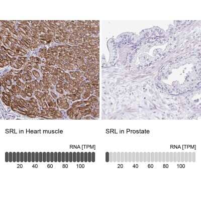 Immunohistochemistry-Paraffin: Sarcalumenin Antibody [NBP2-13378]