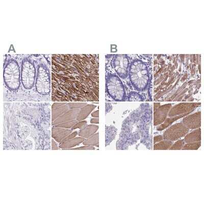 Immunohistochemistry-Paraffin: Sarcalumenin Antibody [NBP2-13378]