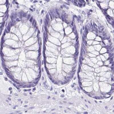 Immunohistochemistry-Paraffin: Sarcalumenin Antibody [NBP2-13378]