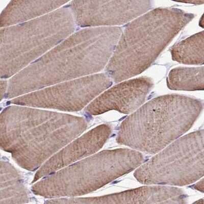 Immunohistochemistry-Paraffin: Sarcalumenin Antibody [NBP2-13378]