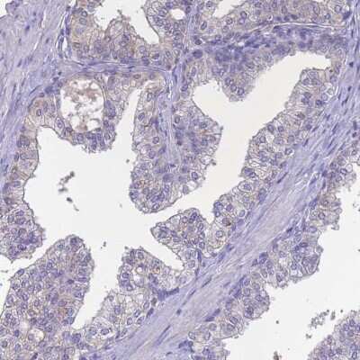Immunohistochemistry-Paraffin: Sarcalumenin Antibody [NBP2-13379]