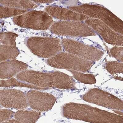 Immunohistochemistry-Paraffin: Sarcalumenin Antibody [NBP2-13379]