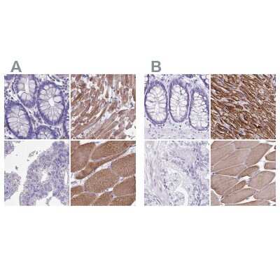 Immunohistochemistry-Paraffin: Sarcalumenin Antibody [NBP2-13379]