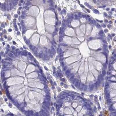 Immunohistochemistry-Paraffin: Sarcalumenin Antibody [NBP2-13379]