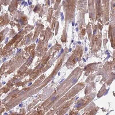 Immunohistochemistry-Paraffin: Sarcalumenin Antibody [NBP2-13379]