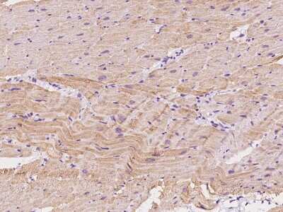 Immunohistochemistry-Paraffin: Sarcalumenin Antibody [NBP2-97668]