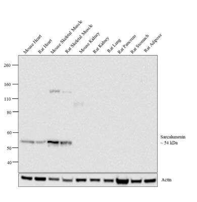 Western Blot: Sarcalumenin Antibody (XIIC4)BSA Free [NB120-2874]