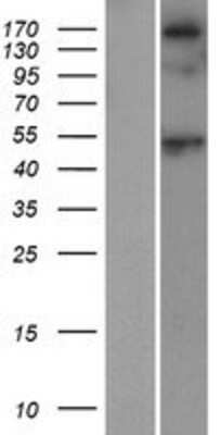 Western Blot: Sarcalumenin Overexpression Lysate [NBP2-10937]