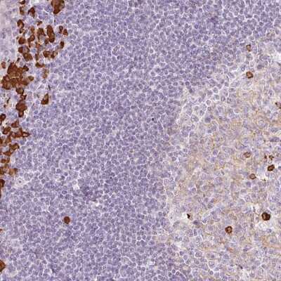 Immunohistochemistry: Sarcoma Antigen NY-SAR-27 Antibody [NBP2-30709]