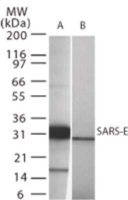 Western Blot: Sars Envelope Protein Antibody [NB100-56562]